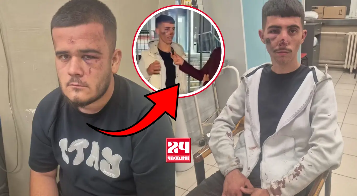 ПОЛИЦАЕЦ АЛБАНЕЦ ОД КРИМИНАЛИСТИЧКА ПОЛИЦИЈА „ГЛАВЕН ТЕПАЧ“ НА МОМЧИЊАТА: Албанци полицајци ги привеле младите Албанци кои истепани излегоа пред камера